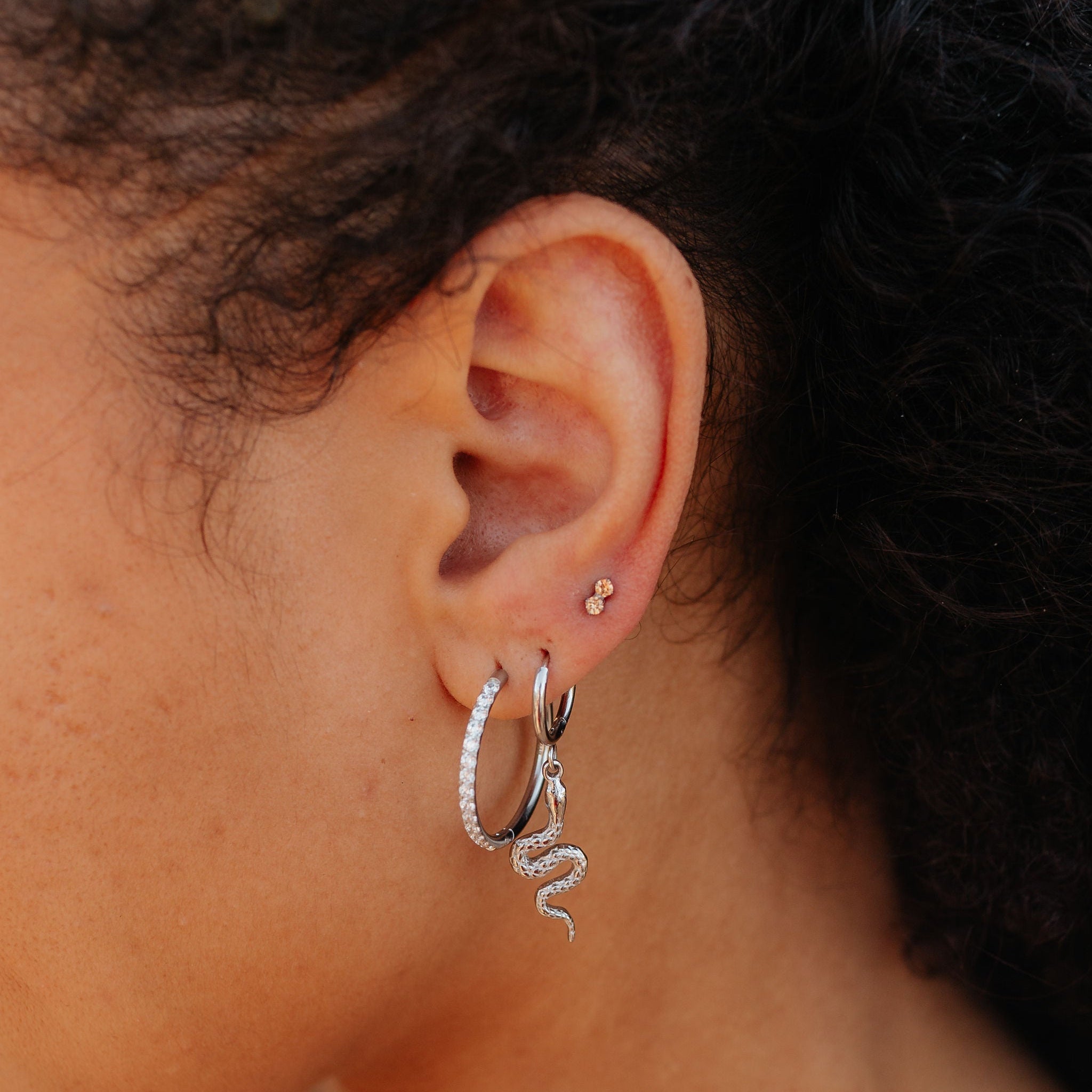 Is Titanium Hypoallergenic